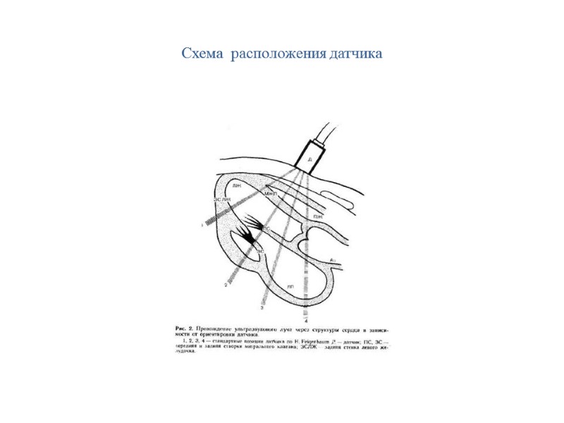 Схема  расположения датчика